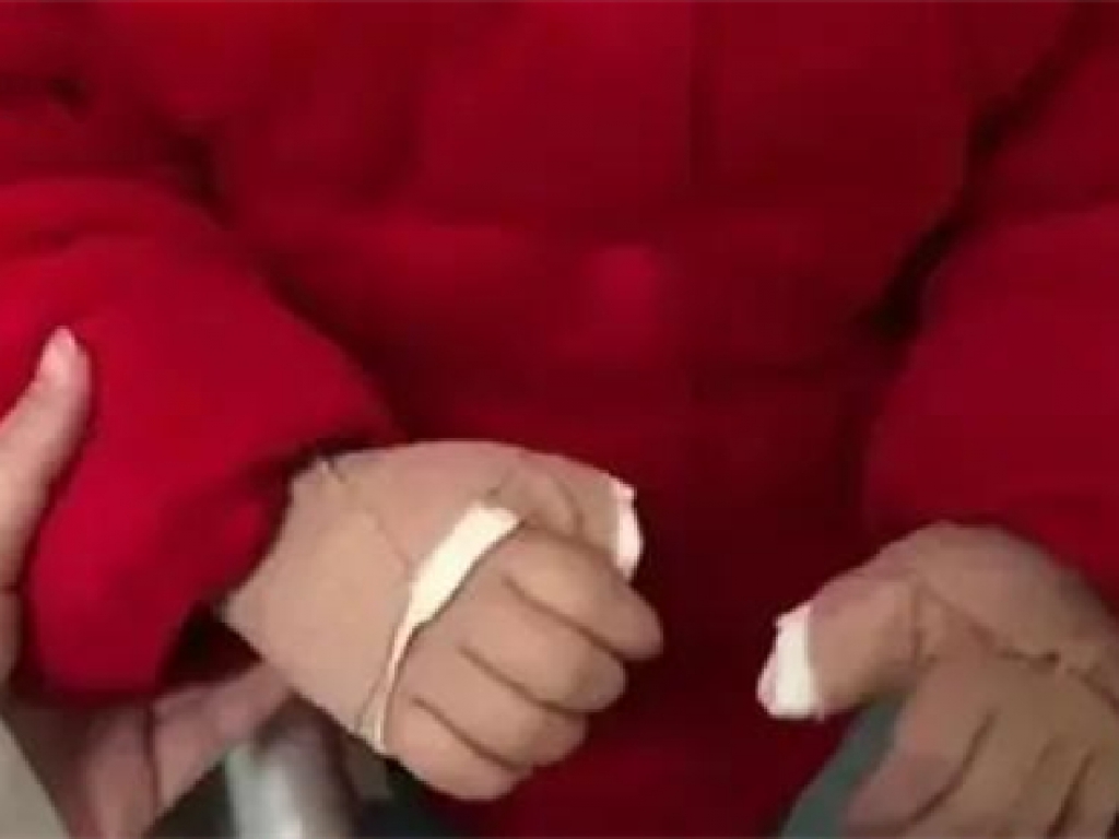 家長們，別再把手機(jī)當(dāng)“哄娃利器”，3歲娃因此手指僵硬伸不直